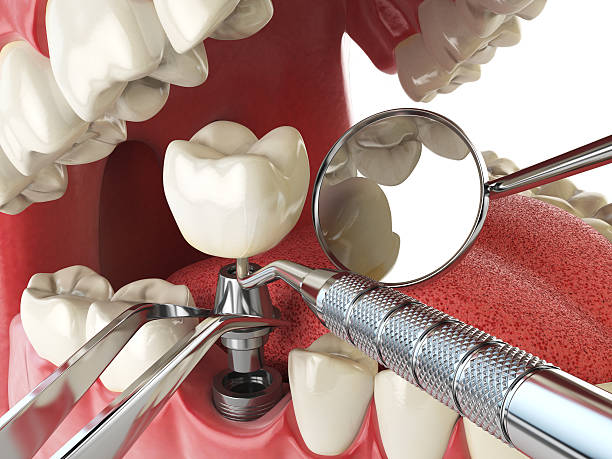 Best Same-Day Emergency Dental Services in Bamberg, SC